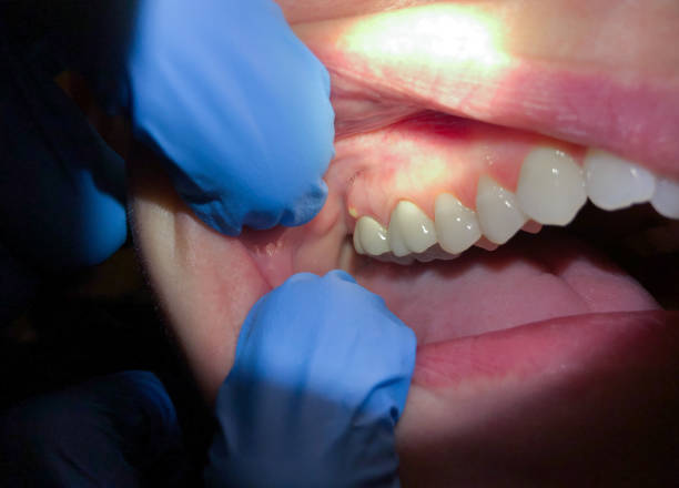 Best Urgent Dental Care for Toothache in Toppers, OK
