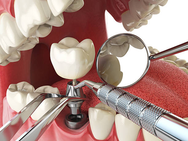 Best Emergency Cosmetic Dentistry in Toppers, OK